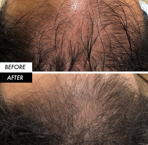 before after hair before after hair