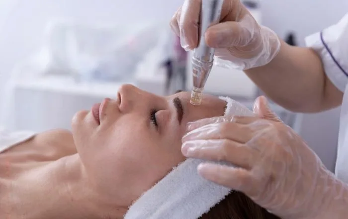 Dermapen microneedling in progress with serum being applied to the skin