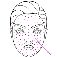 microneedling-treatment copy microneedling-treatment