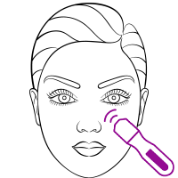 rf-treatment