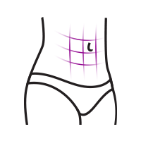 Body Skinbooster Treatment Body Skinbooster Treatment