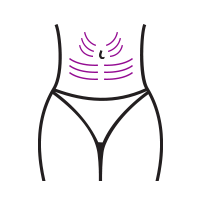 Body Threads Treatment Body Threads Treatment