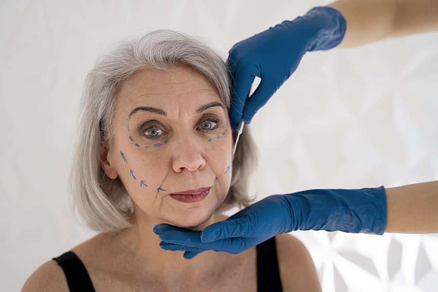 Non-Surgical Thread Lifting