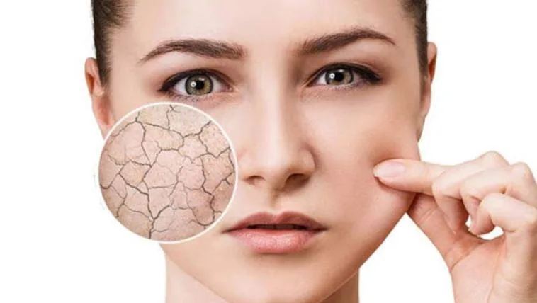 Skin dehydration treatment in Dubai with Dr Azra Vaziri