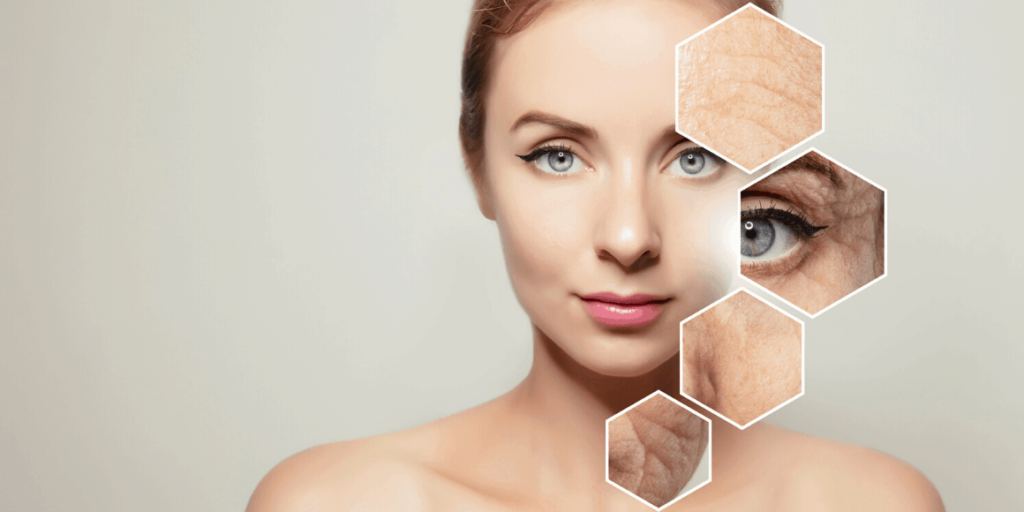 Skin texture improvement treatment in Dubai by Dr Azra Vaziri