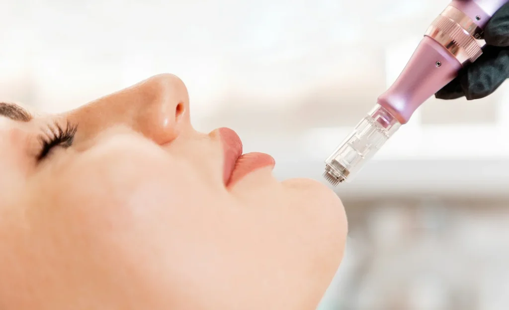 Exosome therapy in Dubai by Dr. Azra Vaziri &mdash; exosomes applied through microneedling channels