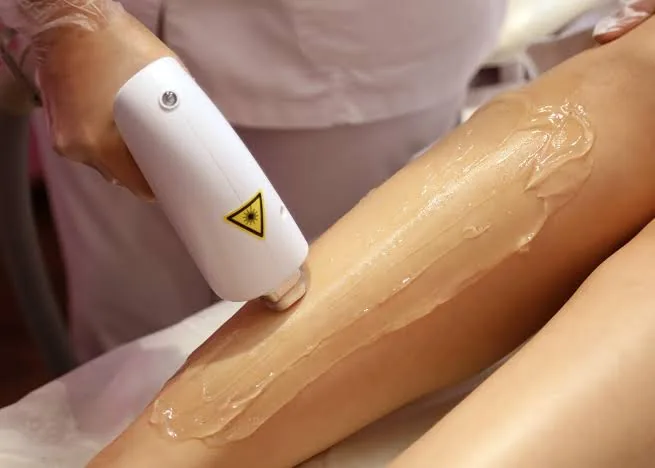 جلسة إزالة الشعر بالليزر للساقين بجهاز Candela GentleMax Pro في أبوظبي